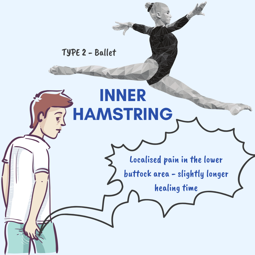 2 Inner Hamstring.png